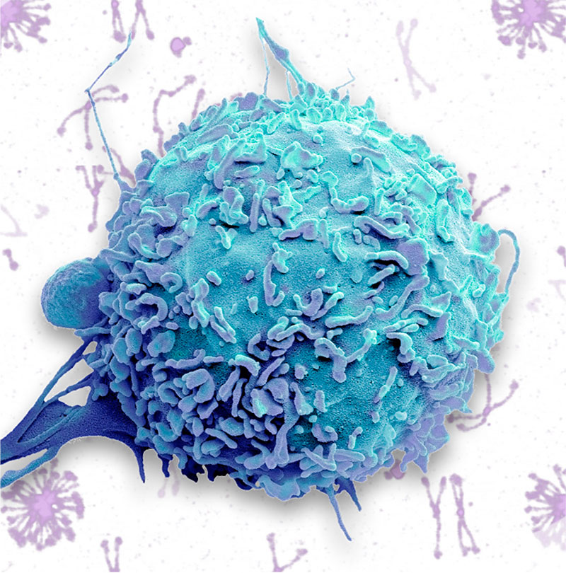 inflamation-image-opt